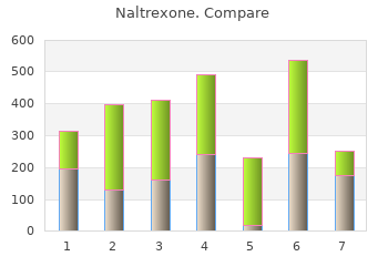 order naltrexone 50 mg with mastercard