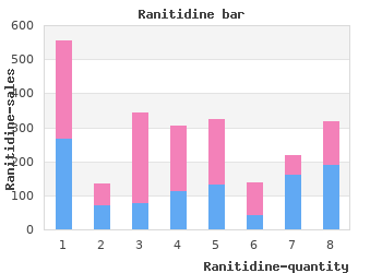 discount ranitidine 150 mg